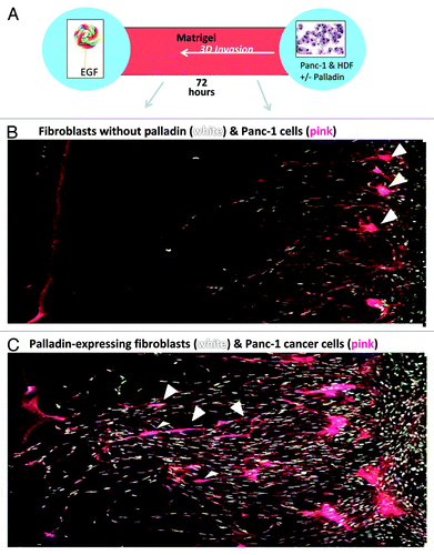 Figure 3. The cartoon in (A) depicts the 3D invasion culture chamber: two wells, one containing fibroblasts and cancer cells (right) and the other filled with chemoattractant EGF (left) are separated by a chamber filled with matrigel. Fibroblasts without palladin (B) and with palladin (C) were co-cultured with pancreatic cancer ductal cell line, Panc-1, over a period of 72 h. Fibroblasts were stained with white Q-dots and cancer cells were stained pink. Note in (C), the palladin-expressing fibroblasts tunneled through the matrigel and were followed by the pink cancer cells (arrow heads) as the cells moved toward the EGF. In (B), pancreatic cancer cells remained at the baseline and did not invade in the 3D cultures when the fibroblasts did not express palladin. Wounding media was provided in all of the 3D invasion cultures.