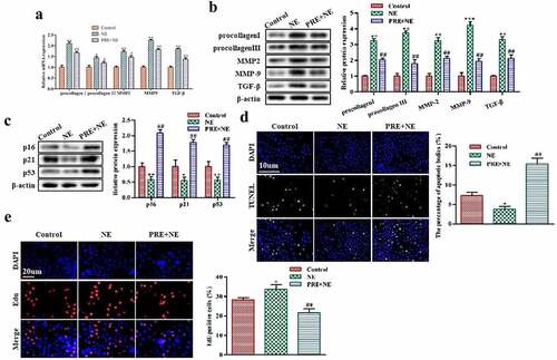 Figure 3. The effect of myocardial hypertrophy preconditioning on premature senescence of cardiac fibroblasts in vitro. (a,b): The levels of procollagen I, procollagen III, MMP2, MMP9, and TGF-β proteins in cardiac fibroblasts were evaluated using western blot analysis. (c): the protein expression levels of p16, p21, and p53 in cardiac fibroblasts were analyzed using western blotting. (d): the TUNEL assay was performed on cardiac fibroblasts, and TUNEL-positive cells were stained green. (e): to detect proliferation, EdU staining was performed on cardiac fibroblasts. **P < 0.01, *P < 0.05 vs. Control, ##P <0.01, #P <0.05 vs. NE. Data were presented as mean±SD from three independent experiments.