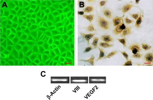 Figure 2 Characterization of HECs. (A) Morphology of HECs. (B) Immunocytochemistry showed that the cell cultures were positive for factor VIII. (C) Reverse transcription PCR analysis demonstrated that the isolated cells expressed factor VIII and VEGF2 mRNA. Bar =50 μm.Abbreviations: HEC, hemangioma endothelial cell; PCR, polymerase chain reaction; VEGF2, vascular endothelial growth factor 2.