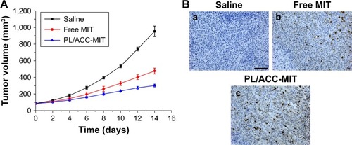 Figure 7 (A) Tumor volume and (B) representative images of ex vivo tumor sections assayed by immunohistology using TUNEL antibodies.Notes: Scale bar: 200 µm. a for saline, b for free MIT and c for PL/ACC-MIT.Abbreviations: ACC, amorphous calcium carbonate; MIT, mitoxantrone; PL, phospholipid.