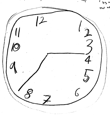 Figure 1 ASD-Y DAC drawing with qualitative errors: Size: Macrographic (larger than 12.7 cm). Graphomotor: wobbly circle, duplicated lines and, numbers (a repetitive behaviour), some tilted, and an oversized minute hand. Spatial planning: all numbers present but crowded to right; uneven spaces with noted gaps bottom center and left. Conceptualization: all numbers present in correct sequence but 12–6 and 9–3 not opposed shows lacks understanding these as traditional orienting points on a clock to facilitate time reading.