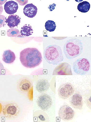 Figure 2. Image composite of granulocytes from a hognose snake stained with various cytochemical stains (objective ×100). (A) Wright–Giemsa stain, (B) Toluidine blue, (C) PAS, (D) Alcian blue, (E) Chloroacetate esterase, (F) Luna, and (G) ALP. Note the positive reaction for Toluidine blue, PAS, and Alcian blue.