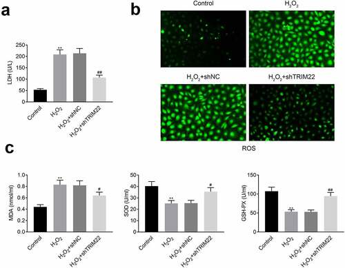 Figure 4. Knockdown of TRIM22 relieved the oxidative stress of lens epithelial cells. (a) The levels of LDH in lens epithelial cells was determined with the commercial kits. (b) The production of ROS was detected with the commercial kits. (c) The levels of MDA, SOD and GSH-PX were determined with the commercial kits. ** p < 0.01, ## p < 0.05