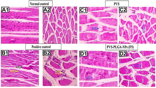 Figure 11 Microscopic pictures of H&E stained longitudinally sectioned skeletal muscles showing normal organization of striated muscle fibers with peripherally located nuclei in negative control group (A1). The longitudinally sectioned skeletal muscles from the positive control group (B1) showing hyaline degeneration (black arrow) in some sections, marked lipid infiltration in muscle fiber and marked mononuclear cells infiltration in interstitial tissue (yellow arrow). The longitudinally sectioned skeletal muscles in the free PVS-treated group (C1), showing moderate lipid infiltration in muscle fibers (blue arrow) and in the F5 nanoparticles-treated group (D1), showing lower lipid infiltration in muscle fibers (blue arrow). The crossly sectioned skeletal muscles showing normal muscle fibers with peripherally located nuclei in negative control group (A2). The crossly sectioned skeletal muscles from positive control group (B2) showing marked lipid infiltration, mild mononuclear cells infiltration (yellow arrows) in muscle fibers and hyaline degeneration in some sections with mild mononuclear cells infiltration. The cross-sectioned skeletal muscles from the free PVS-treated group (C2) showing moderate lipid infiltration in muscle fibers (blue arrow) and in the F5 NPs-treated group (D2) showing very mild lipid infiltration in muscle fibers (blue arrow).