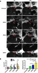 Figure 11 Magnetic resonance molecular imaging.Notes: (A) MRI of mixed thrombus in the abdominal aorta of SD rats before and after intravenous administration of different NPs. Red circles show the abdominal aorta with mixed thrombus. (B) Quantitative analysis of the change in the hyperintensity areas of the thrombus. The high signal area of the thrombus was significantly decreased after injection in the targeting groups, especially in the dual-targeted group. (*P<0.05, **P<0.01).Abbreviations: PLGA-pDA, polydopamine-coated poly(lactic-co-glycolic acid) dual-modality nanoparticles; RDNPs, PLGA-pDA modified by the cRGD peptide; EDNPs, PLGA-pDA modified by the GA-EWVDV peptide; DDNPs, dual-modality and dual-ligand nanoparticles.