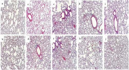 Figure 6. Photomicrograph of lung section (Masson’s trichrome; x100) from normal control group showing normal alveolar structure with no collagenous fibers (grade 0) of fibrosis (Figure 6(a,b)). Lung section from DEX group after 14 days showing grade 2 fibrosis representing presence of simple collagenous fibers (Figure 6c). DEX group after 28 days showed (grade 1) of fibrosis with the presence of some collagenous fibers (Figure 6d)