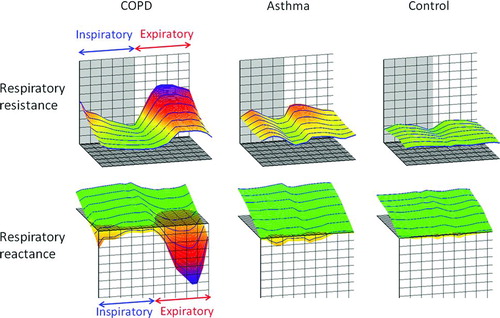 Figure 2  Colored 3 dimensional visualization of arithmetic means of oscillatory properties in a respiratory cycle in each representative subject.