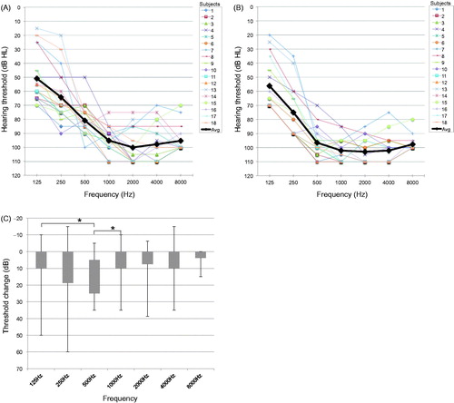 Figure 1. Individual and average (bold black line) hearing thresholds pre- (A) and at 6 months post-operatively (B). Threshold changes from 125 to 8000 Hz between the pre-operative and 6 months post-operative values (C). Statistically significant differences were calculated using Tukey’s test (*significant difference <0.05).