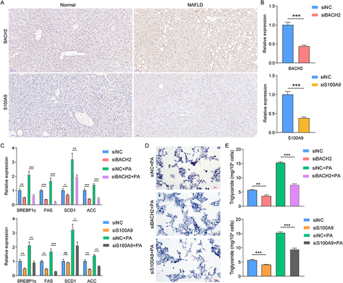 Figure 8 Detecting the role of BACH2 and S100A9 in NAFLD cells. Representative immunohistochemistry images of BACH2 and S100A9 in mice livers (scale bars, 50μm) (A). The knock-down of BAHC2 and S100A9 (***P < 0.001) (B). PCR to detect several maker genes of lipid accumulation after transfection (ns, not significant; *P < 0.05; **P < 0.01; ***P < 0.001) (C). Representative images of oil red O staining (scale bars, 50μm) (D). Triglyceride detection (**P < 0.01; ***P < 0.001) (E).