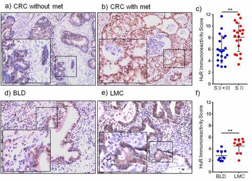 Figure 1. HuR expression in CRC patients with metastasis was detected using IHC. (a) CRC patients without metastasis (magnification, 200×) and (b) CRC patients with metastasis (magnification, 200×). (c) HuR IRS in CRC patients (stage II–III and stage IV). (d) HuR expression in benign lung disease and (e) HuR expression in lung metastases from the colon. (E) HuR IRS in lung metastases from the colon and benign lung disease. The student’s t-test was used to analyze differences between the two groups. The data are presented as the mean ± SEM value. **p < .01. BLD: benign lung disease, LMC: lung metastasis from the colon.