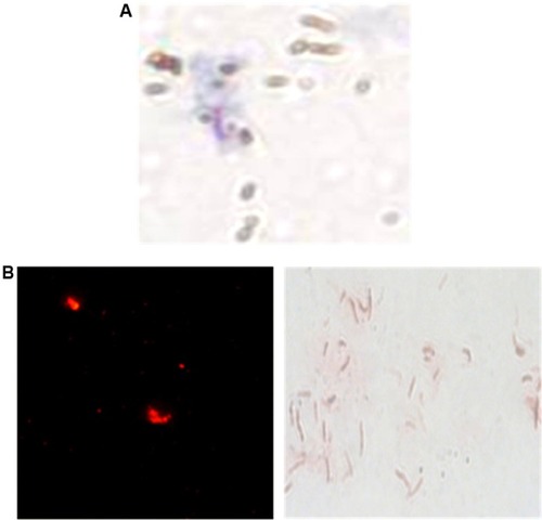 Figure 3 Microscopic observation of H37Rv bacilli, captured by the H8 conjugated MMSs.Notes: (A) Ziehl–Neelsen stain 1,000× and QDs. (B) direct fluorescence observation 400× and Ziehl–Neelsen stain 1000×.Abbreviations: MMSs, magnetic microspheres; QDs, quantum dots.