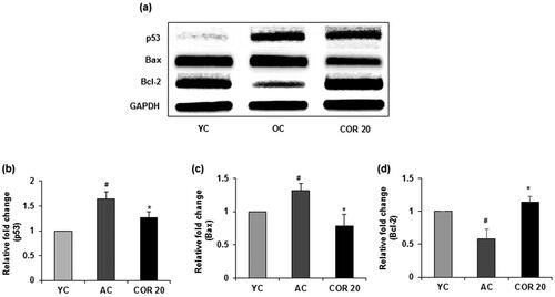 Figure 10. Effect of COR on testicular pro- and anti-apoptotic related mRNA expression in aged rats. RT-PCR analysis of p53, Bax and Bcl-2 mRNA expression (a). Relative expression levels (fold) of p53 (b), Bax (c) and Bcl-2 (d) in three independent experiments, respectively. GAPDH was used as an internal control. Data are expressed as the mean ± SD (n = 6). #p < 0.05 compared with YC group and *p < 0.05, compared to AC group. YC: young rats; AC: aged rats; COR 20: cordycepin (COR) 20 mg/kg treated aged rats; Bcl-2: B-cell lymphoma-2; Bax: Bcl-2-associated X; RT-PCR: reverse transcriptase-polymerase chain reaction.