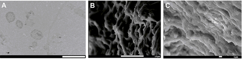 Figure 4 Micrographs obtained by different techniques: (A) TEM of TH-NLC (scale bar 500 nm), (B) SEM image of TH-NLC incorporated into carbomer gel (GC-TH-NLC, scale bar 10 µm) and (C) SEM image of GC-TH-NLC (scale bar 1 µm).