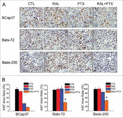 Figure 6. Raloxifene with paclitaxel reduces proliferation of MDR cell lines in vivo. (A) Ki-67 immunohistochemistry staining of Bcap37, Bats-72, Bads-200 tumors after various treatments. (B) Quantitative analysis of Ki-67 positive area percentage. Data are presented as mean ± standard error based on 5 randomly selected microscopic fields for each group. *P < 0.05 versus PTX.