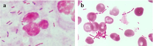 Figure 2 Gram-stain of pus obtained by computed tomography-guided abdominal abscess drainage (a) and a positive anaerobic blood culture 20 hours after collection (b). The Gram-stain shows gram-negative rods with phagocytosis of leukemic cells in the pus obtained abdominal abscess (a) and gram-negative rods in the anaerobic blood culture (b) (magnification; ×1000).