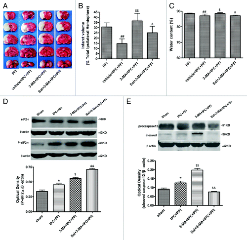 Figure 6. Salubrinal (Sal) inhibited 3-MA-induced neuronal damage. Rats were treated with a single i.c.v injection of Sal (75 pmol); 10 min later, 3-MA (200 nmol) was administered 5 min before the onset of IPC (10 min MCA occlusion). Lethal ischemia was induced by PFI. Rats were killed 24 h after ischemia. (A) TTC staining of brain sections. Infarct brain regions display white after TTC staining. (B) Quantitative analysis of brain infarct volume. (C) Sal pretreatment decreased brain edema. (D and E) Extracts from the ischemic and sham-operated cortex were separated on SDS-PAGEL and protein levels were detected with immunoblotting. Levels of β-actin protein were used as the loading control. Quantitative analysis was performed with Sigma Scan Pro 5. (D) Protein expression of P-eIF2α and eIF2α. (E) Protein expression of caspase-12. Bar represents mean ± SD, n = 6. *p < 0.05, **p < 0.01 compared with the sham-operated group; #p < 0.05, ##p < 0.01 compared with PFI group. $p < 0.05, $$p < 0.01 compared with the IPC+PFI group; &p < 0.05, &&p < 0.01 compared with the 3-MA+IPC+PFI group.