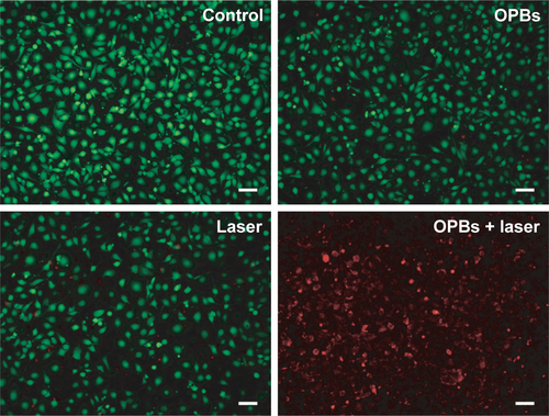 Figure S5 PTT effect assessed by fluorescence images.Notes: Fluorescence images of 4T1 cells costained with calcein AM (live cells, green) and PI (dead cells, red) after different treatments: control, OPBs only, laser only, and OPBs plus laser. Scale bars: 50 mm.Abbreviations: OPBs, optimized Prussian blue nanoparticles; PI, propidium iodide; PTT, photothermal therapy.