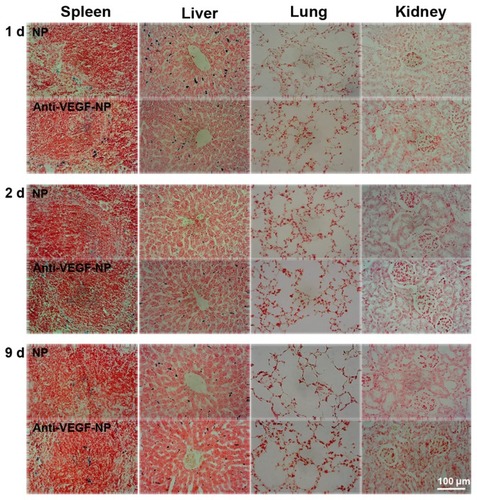 Figure 5 Anti-VEGF-NPs or NPs are present in the spleen and liver, but not the lung and kidney, as shown by Prussian blue staining.Notes: The spleen, liver, lung, and kidney were harvested from mice bearing colon tumors, paraffin-embedded, sectioned, and stained with Prussian blue staining at day 1, 2, or 9 after anti-VEGF-NP or NP injection. Scale bar = 100 μm.Abbreviations: VEGF-NPs, vascular endothelial growth factor; NPs, nanoparticles.