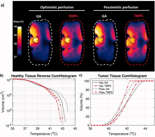 Figure 8. Temperature simulation result for the bladder tumor setup, comparing a selected GA Pareto configuration with the TMPS optimized one, using an optimistic and a more pessimistic perfusion thermoregulation model. Axial temperature distribution cross-section through the tumor (a), corresponding temperature cumulative histograms for the healthy tissue (b), and tumor region (c).