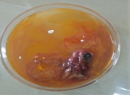 Figure 11 In ovo antiviral activity of CuO nanorods against R2B strain of Newcastle disease virus.