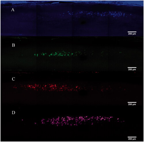 Figure 4. MIP images of single track. (A) Tibialis anterior motor neurons labelled by FG. (B) Soleus motor neurons labelled by CTb-488. (C) Gastrocnemius motor neurons labelled by CTb-488. (D) Lateral muscle motor neurons labelled by CTb-647.