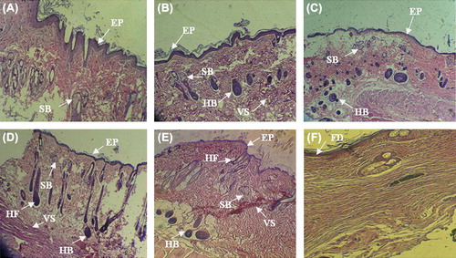 Figure 5. Histology of wounds by H&E staining in the different groups on post-operative day 21. A) The nanofibrous PHBV scaffold without USSCs. B) The nanofibrous PHBV scaffold with USSCs. C) The collagen-coated nanofibrous PHBV scaffold without USSCs. D) The collagen-coated nanofibrous PHBV scaffold with USSCs. E) The normal skin. F) control. (Abbreviations: FD fibrinous debris; EP – epithelialization; HF – hair follicle; HB – hair bulb; SB – sebaceous gland; VS – vascularized section). Scale bars: 200 m.