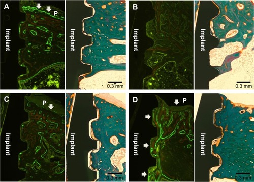 Figure 8 Fluorescence and histologic staining images 8 weeks after implant installation.Note: (A) Machined surface group, (B) SLA surface group, (C) TiO2 nanotube array surface group, and (D) TiO2 nanotube array surface with rhBMP-2 group. P indicates a periosteum area. The white arrow indicates a region of bone formation and bone remodeling.Abbreviations: TiO2, titanium dioxide; rhBMP-2, recombinant human bone morphogenetic protein-2; SLA, sandblasted large-grit and acid-etched.