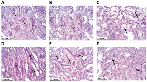 Figure 6. Protective effect of boswellic acids for renal tissues in mice treated with doxorubicin using Periodic acid-Schiff staining (PAS). Scale bar = 30 µm. A (saline group) and B (BAs 500 mg/kg control group) show the normal architecture of renal parenchyma with an expression of PAS positive material in the basement membrane and the cilia of the epithelium lining the proximal convoluted tubules (arrow). C: DXR control group shows tubular disorganization and lack of PAS positive material expression within the tubular epithelium. D, E & F: DXR+BAs (125, 250 or 500 mg/kg), respectively. Restoration of the tubular epithelium took place in the 3 groups but clearly seen the highest dose of BAs indicated by the PAS positively stained brush border (arrow). DXR: doxorubicin, BAs: boswellic acids, PAS: periodic acid-Schiff.
