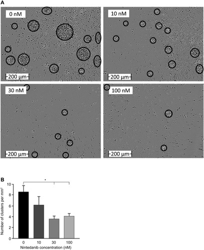 Figure 3 Nintedanib decreases T-cell clustering. (A) Images were taken using an IncuCyte ZOOM live imager of highly purified T cells from healthy donors after 48 hours of activation with αCD3/αCD28, αIL-4, αIFN-γ and IL-2 and pretreated with or without nintedanib at 10, 30 and 100 nM. Scale bar (0–200 µm). (B) The number of clusters per square millimeter is shown for n=5–18 time-lapse videos over 48 hours of n=4–6 donors. Data presented as mean ± standard error of mean, *P<0.05.