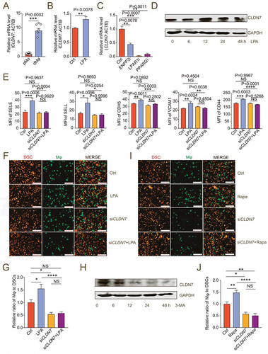 Figure 6. LPA/autophagy-mediated adhesion and residence of dMφ is dependent on CLDN7. (a) Transcription level of CLDN7 in pMo (n = 7) and dMφ (n = 6) by RT-PCR. (b) Transcription level of CLDN7 in control or LPA-treated (10 mM for 12 h) M0 macrophages by RT-PCR. (c) Transcription level of CLDN7 in control, ENPP2 inhibitor (100 nM), LPAR1 inhibitor (100 nM) or PPARG inhibitor (3.3 nM)-treated M2 macrophages by RT-PCR (12 h). (d) Western-blot for CLDN7 expression of M0 macrophages after treatment with LPA (10 μM) for 0, 6, 12, 24 or 48 h. (e) Flow cytometry assays for adhesion molecule expression of control, LPA-treated (10 μM for 24 h), CLDN7-silenced (siCLDN7) or LPA-treated (10 μM for 24 h) siCLDN7 macrophages. (f and g) Adhesion assays of control, LPA-treated (10 μM for 24 h), siCLDN7 or LPA-treated (10 μM for 24 h) siCLDN7 green-fluorescent dMφ to PKH-26-labeled red-fluorescent DSCs (n = 5). (h) Western-blot for levels of CLDN7 of M2 macrophage after treatment with 3-MA (10 mM) for 0, 6, 12, 24 or 48 h. (i and j) Adhesion assays of control, rapamycin-treated (2 μM for 24 h), siCLDN7 or rapamycin-treated (2 μM for 24 h) siCLDN7 green-fluorescent dMφ to red-fluorescent DSCs (n = 5). Data were presented as mean ± SEM and analyzed by t test or one-way ANOVA test. *P < 0.05, **P < 0.01, ***P < 0.001, ****P < 0.0001, NS: no significance.