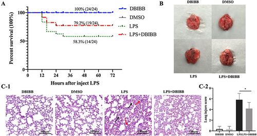 Figure 6 LPA2 reduces lung injury and mortality in LPS-treated mice. (A) Mice survival in all treatment groups (n = 24). (B) Representative images showing the mice lung tissue from each treatment group (n = 24). (C-1) Representative HE staining of the mice lung tissue for each treatment group. Red arrows indicate inflammatory cell infiltration, black arrows indicate thickening of the alveolar walls. Scale bar, 100 μm. (C-2) Quantification of the lung injury area was assessed by histological scores (n = 6), *p < 0.05 vs LPS group.