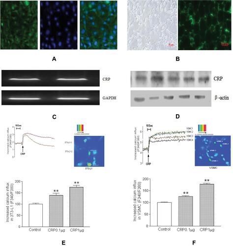 Figure 1 CRP distribution and effects on the cytosolic calcium levels in cultured cells. Immunofluorescence staining of CRP in 3T3-L1 preadipocytes (A) and adipose tissue (B), green fluorescence represents CRP distribution, while blue fluorescence represents the nucleus (A and B). Representative RT-PCR and Western blot of CRP from human mesenteric adipose tissue (C and D). The quantitative results are shown below. Data are expressed as mean ± SD. Representative traces and ratio fluorescence imaging showed the effect of CRP (1 µg/mL) on calcium ([Ca2+]i) in cultured 3T3-L1 preadipocytes (E) and vascular smooth muscle cells (VSMC) (F). The quantitative results and dose-dependent CRP effects on [Ca2+]i are shown (n=6 in independent experiments). Data are expressed as mean ± SD,**p<0.01 versus control.