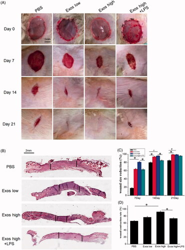 Figure 4. (A) Representative images of full-thickness skin defects in a diabetic rat model untreated (PBS) or treated with low Exos (100 μg/mL), high Exos (1 mg/mL), or high Exos (1 mg/mL) + LPS (10 μg/mL) at 0 days, 7 days, 14 days, and 21 days after operation. The scale bar in all Figure 4(A) is 5 mm. (B) Transmitted light images of H&E-stained sections of the untreated defects (PBS) and defects treated with low Exos, high Exos, or high Exos + LPS at day 7 after operation. (C) The wound size reduction in wounds receiving different treatments based on representative images of full-thickness skin defects in a diabetic rat model. The data are represented as the means ± SD (n = 3), #p<.05, compared PBS group with high Exos levels (1 mg/mL), *p < .05. (D) Determination of wound contraction rate based on transmitted light images of H&E-stained sections. The data are represented as the means ± SD (n = 3), *p < .05.