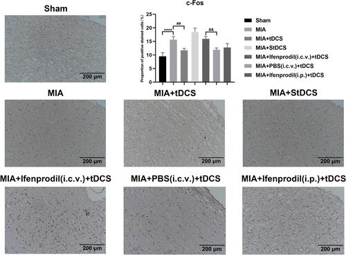 Figure 4 Immunohistochemical staining for c-Fos in all groups. Scale bars: 200 µm. The proportion of positive stained cells were presented as the mean ± SEM (n=4/group). ****P<0.001, MIA group vs Sham group; ##P<0.01, MIA+tDCS group vs MIA group; &&P<0.01, MIA+PBS (i.c.v.)+tDCS vs MIA+Ifenprodil (i.c.v.)+tDCS group.