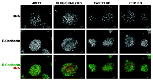 Figure 8. Mammosphere morphology of basal/HER2+ JIMT1 cells in response to the specific knockdown of SLUG/SNAIL2. The impact of shRNA-driven genetic ablation of SLUG/SNAIL2, TWIST1 and ZEB1 in mammosphere morphology was determined after seeding JIMT1 parental cells and SLUG/SNAIL2 KD-JIMT1, TWIST1 KD-JIMT1 and ZEB1 KD-JIMT1 cells in ultralow attachment plates with mammosphere medium for 5–7 d. Immunostaining of E-cadherin was performed on established spheres to visually evaluate whether the knockdown of EMT transcriptional drivers may result in disrupted mammosphere morphology. Genetic ablation of EMT drivers by lentivirus-delivered shRNAs did not affect mammosphere morphology of basal/HER2+ JIMT1 cells. KD, knockdown