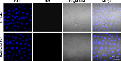 Figure S4 No DiO significant fluorescence signal detected in HepG2 cells untreated or in HepG2 cells incubated with unlabeled exosomes.Abbreviation: DiO, 3′-dioctadecyloxacarbocyanine perchlorate.