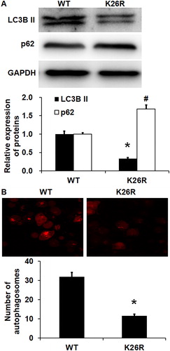 Figure 6. Effect of wild-type (WT) or K26R Beclin1 on the autophagy of HUVECs. (A) Expression of LC3B II protein and p62 protein in HUVECs with WT or K26R Beclin1. Western blotting was used to determine protein expression. *p < 0.05 compared with WT group for LC3B II protein; #p < 0.05 compared with WT group of p62 protein. (B) Number of autophagosomes in HUVECs with WT or K26R Beclin1. Laser scanning confocal microscopy was used to determine the number of autophagosomes. *p < 0.05 compared with WT group for LC3B II protein; #p < 0.05 compared with WT group of p62 protein.