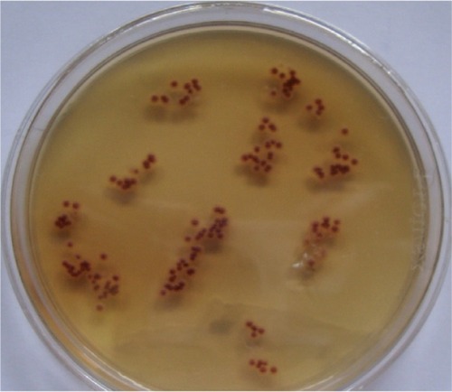 Figure 5 Violet pigment-producing Trichophyton violaceum.