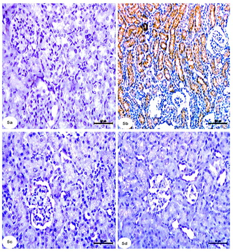 Figure 5. Photomicrographs from immunohistochemistry of kidney section of rats showing (a): control group with negative immunoreaction for p53 in renal tubules. (b): Group CCl4 showing strong positive immunoreaction for p53 in tubular cells of kidney. (c): CCl4 + rats BM-MSCs and (d): CCl4 + mice BM-MSCs showing poor immunoreaction for p53 in tubular cells of the kidney. (Immunostaning for p53; Scale bar of a, c, and d = 50 µm, Scale bar of b = 100 µm).