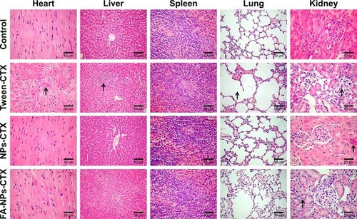 Figure 9 Histological images of major organs excised from HeLa tumor-bearing nude mice after treatment with NS (control), Tween-CTX, NPs-CTX, and FA-NPs-CTX at Day 20.Note: The images were obtained using a digital microscope at 400× magnification, and major tissue damages are marked with arrows.Abbreviations: CTX, cabazitaxel; FA, folic acid; FA-NPs-CTX, FR-targeted nanoparticles loaded with cabazitaxel; NPs-CTX, cabazitaxel-loaded nanoparticles; NS, normal saline; Tween-CTX, CTX dissolved in a mixture of Tween 80 and 13% ethanol (w/w) at a ratio of 1:4 (v/v).