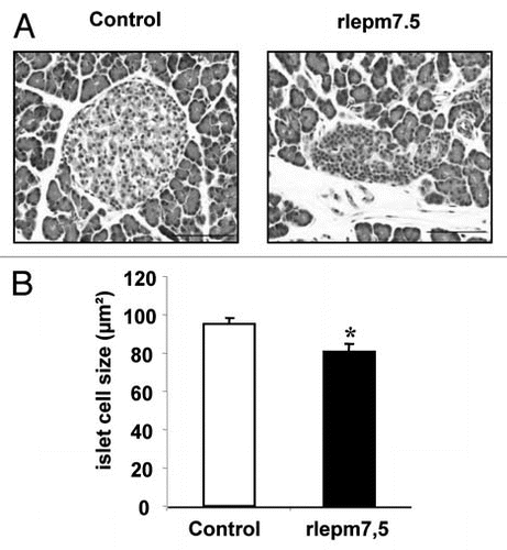 Figure 2 Effect of neonatal treatment on the histological structure of pancreatic islets. (A) Representative pancreas sections showing Langherans islets from control and leptin antagonist-treated rats. Bars = 100 µm. (B) Determination of islet cell size in control and rlepm7.5 animals. Values represent the mean ± SEM, n = 7 and n = 8 in the control and rlepm7.5 groups, respectively. *p < 0.05 between control and rlepm7.5 animals.