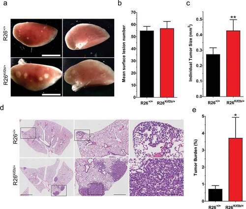 Figure 3. Expression of exogenous Kif2b accelerates mutant K-Ras driven adenoma growth in mice. (a). Representative images of the anterior (left) and posterior (right) surfaces of left lung lobes isolated from control (R26+/+) or Kif2b expressing (R26Kif2b/+) 6 week old K-RasG12D/+ mice. Scale bars, 5mm. (b). The mean number of visible surface lung lesions per K-RasG12D/+ mouse. Bars, mean ± SEM; n ≥ 10 mice per genotype. (c). The mean surface area (mm2) of lung lesions from K-RasG12D/+ mice. Bars, mean ± SEM; n ≥ 100 lesions from 7 mice per genotype; **, P < 0.01, Mann-Whitney test. (d). Representative hematoxylin and eosin (H&E) stained lung tissue sections from K-RasG12D/+ mice. Black boxes indicate magnified region shown in panel directly to the right. Scale bars (left to right), 2 mm, 0.5 mm, and 0.1 mm. (e). Mean tumor burden percentage (tumor tissue area: total lung tissue area) in H&E stained lung sections from K-RasG12D/+ mice. Bars, mean ± SEM; n = 4 mice per genotype; *, P < 0.05, Mann-Whitney test.