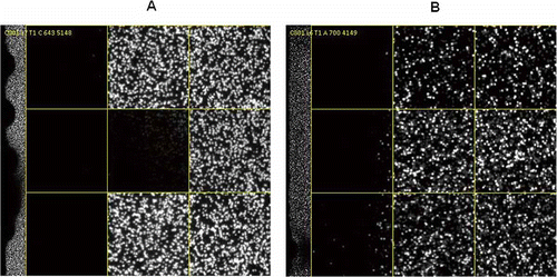 Figure 7. Dark-area FC. (A) Pheonotype as wavy-edge dark area up to 50% of the lane. (B) Phenotype as straight-line and irregular dark area on one end of the lane. This could also lead to sequencing quality problems as low PF, bad focus, low Q20 and high error rate, etc.