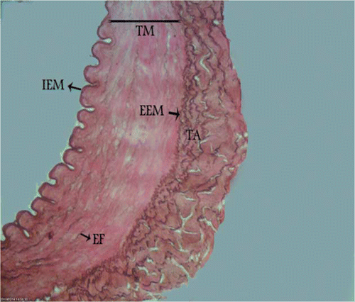 Figure 4.  Photomicrograph – non-transitional zone of canine external carotid artery with fragmented elastic fibres in the media. TM, tunica media; TA, tunica adventitia; IEM, internal elastic membrane; EEM, external elastic membrane; EF, elastic fibres. Orcein stain, 700×, Bar = 25.5 µm.