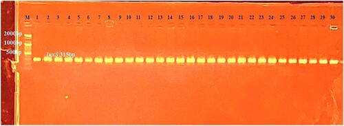 Figure 2. PCR product electrophoresis for luxS gene (315 bp) for E. coli in (1.5% agarose) and TBE (1×) at (75 volt/cm2) in 90 min and marker DNA ladder (100 bp).