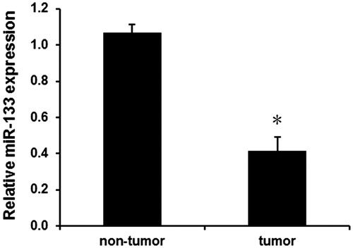 Figure 1. Relative expression levels of miR-133 in glioma. *p < .05.