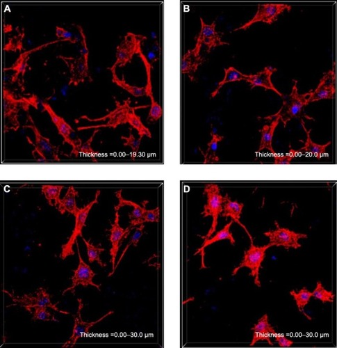 Figure 8 Cytoskeletal morphology of the MG63 cells on the samples for 5 days: VH/rhBMP-2/n-MZS (A) and VH/rhBMP-2/MZS (B) systems; n-MZS (C) and MZS (D) xerogels.Abbreviations: MZS, magnesium–zinc–silicon; n-MZS, nanoporous magnesium–zinc–silicon; rhBMP-2, human bone morphogenetic protein-2; VH, vancomycin hydrochloride.