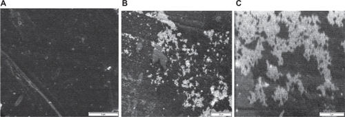 Figure 3 A) Scanning electron microscopy of nongrafted polystyrene. Magnification 5000×. B) Scanning electron microscopy of grafted polystyrene under 10 KGy. Magnification 1000× (scale: 20 μm). C) Magnification 5000× (scale: 5 μm).