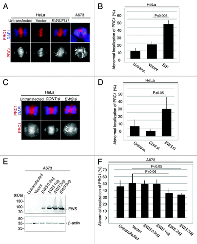 Figure 2. EWS/FLI1-expressing and EWS-knockdown HeLa cells display aberrant localizations of PRC1 at the midzone, and the transfection of Ewing sarcoma A673 cells with EWS rescues the high incidence of aberrant localization of PRC1 at the midzone. (A) Top, merged images, with DNA stained with DAPI (blue) and PRC1 (red) visualized via anti-PRC1 antibody; bottom, PRC1. Untransf., untransfected; vector, empty vector; E/F, human pSG5-2xFLAG-EWS/FLI1-transfected HeLa cells. bottom: PRC1 visualized with anti-PRC1 antibody. (B) The percentages of HeLa cells with mislocalized PRC1. The pSG5-2xFLAG-EWS/FLI-transfected HeLa cells displayed a higher incidence of abnormal PRC1 localization (31 to 72 anaphase cells per sample) (n = 3 experiments). (C) Top, merged images with DNA stained using DAPI (blue), and PRC1 (red) visualized with anti-PRC1 antibody. Untransf, untransfected; CONT si, control-siRNA; EWS si, human EWS siRNA-transfected HeLa cells. Bottom, PRC1 visualized with anti-PRC1 antibody. (D) The percentages of HeLa cells with mislocalized PRC1. The EWS siRNA-transfected HeLa cells display a higher incidence of abnormal PRC1 localization (30 to 56 anaphase were scored for each of the experiment)(n = 4 experiments). (E) Western blotting of A673 cell lysates from untransfected, empty vector-transfected and pSG5-2xFLAG-EWS-transfected cells probed with anti-FLAG antibody to verify transfection, and anti-β-actin antibody control. (F) The percentages of the cells with abnormal localization patterns for PRC1 were scored (n = 3 experiments). The transfection of Ewing sarcoma A673 cells with EWS rescues the high incidence of the aberrant localization of PRC1 at the midzone. (50 to 51 anaphase were scored for each of the experiment)(n = 4 experiments). <, area of midzone with aberrant localization of PRC1; [, area of midzone with localization of PRC1 components.