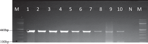 Figure 9. A gel electrophoresis showing the gyrA (441 bp) gene